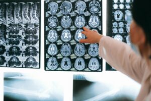 MRI of the Brain
